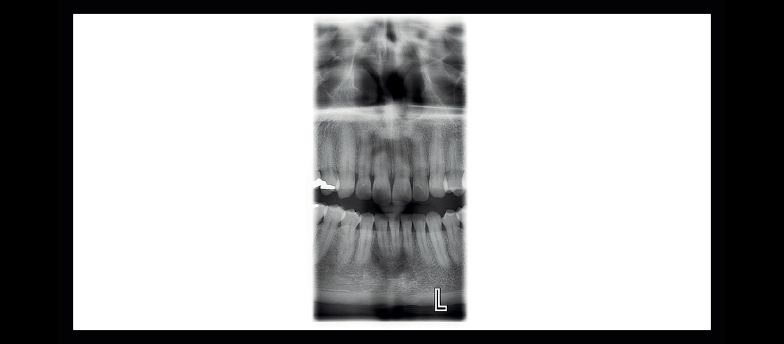 ‘Planmeca ProMax 2D S3