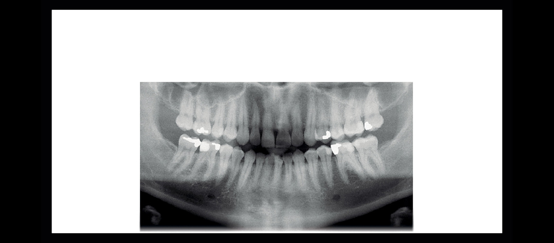 ‘Planmeca ProMax 2D S3