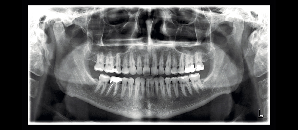 ‘Planmeca ProMax 2D S3