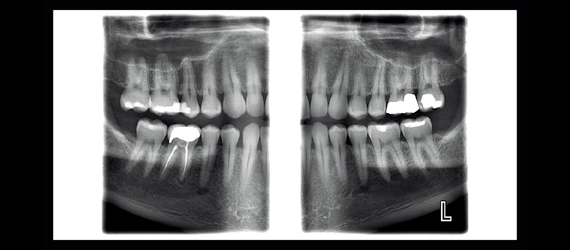 ‘Planmeca ProMax 2D S3