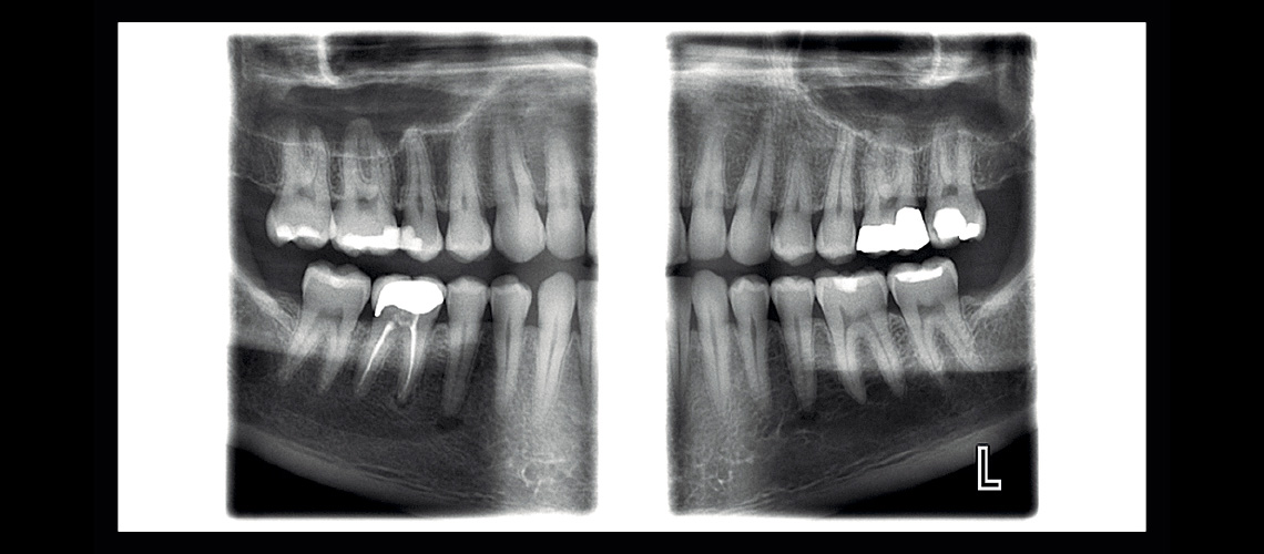 ProMax Clinical Image 5